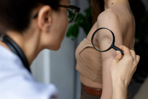 How Painful Is a Mole Removal? 4 How Painful Is a Mole Removal?